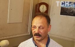 олег барна, скандали, нардеп, синець, алкоголь, фото, тернопільський тиждень
